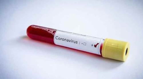 Türkiye'nin koronavirüs tablosunda son 24 saat