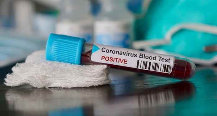 Koronavirüsten 28 kişi daha hayatını kaybetti!