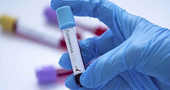Türkiye'de koronavirüs kaynaklı can kaybı sayısı 4007 oldu