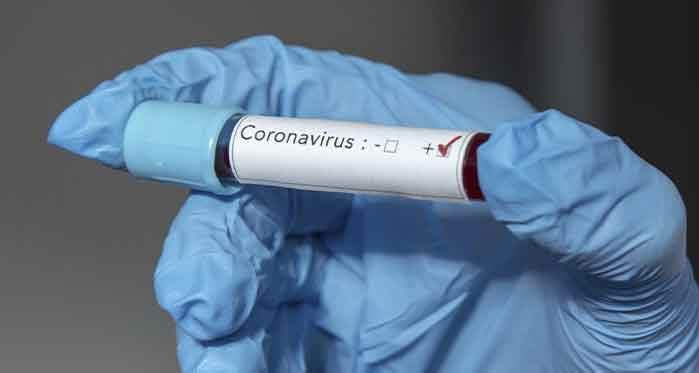Türkiye'de koronavirüs kaynaklı ölü sayısı 3 bin 397 oldu