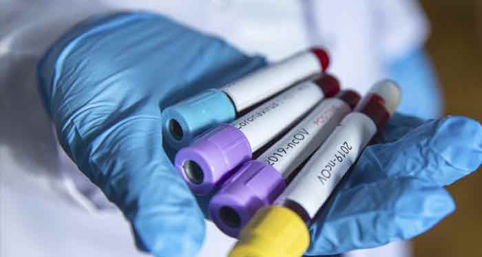 Türkiye'de koronavirüsten can kaybı 3 bin 641'e yükseldi