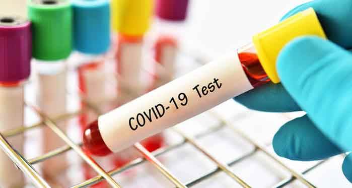 Türkiye'de koronavirüsten hayatını kaybedenlerin sayısı 4 bin 340 oldu