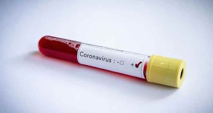 Türkiye'nin koronavirüs tablosunda son 24 saat