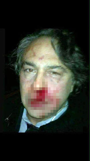 Barbaros Şansal'a saldırı