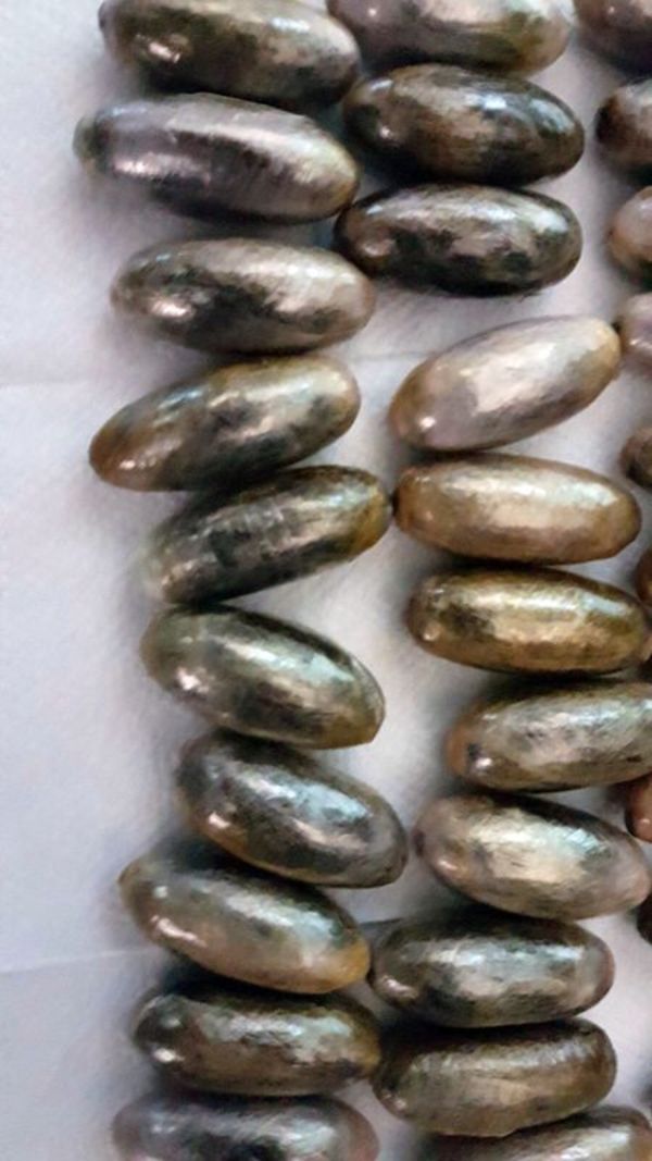 midesinden uyuşturucu çıktı