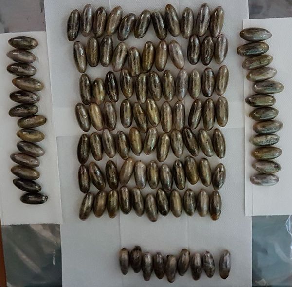 midesinden kapsüller çıktı