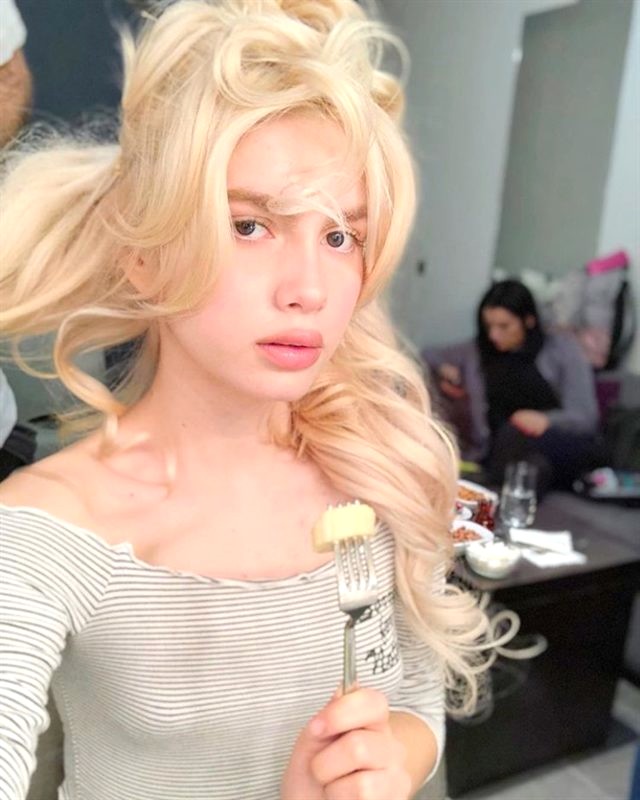 aleyna tilki estetikli dudakları