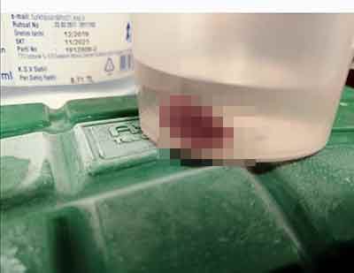 Kopan Parça 06 08 2020