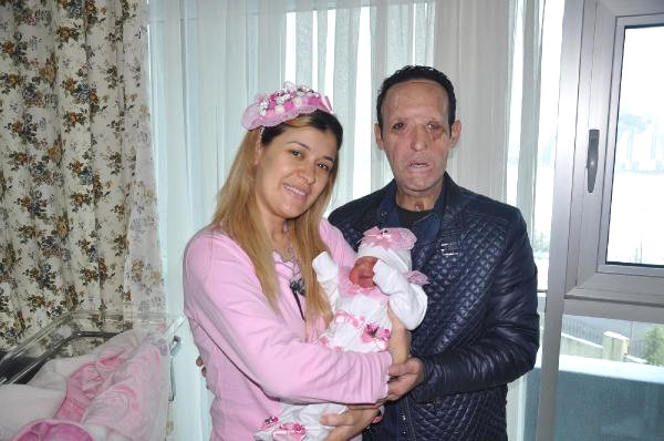 Yüz nakilli Recep Sert tutuklandı