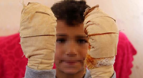 Komşu çocuğu, küçük Efe’ye dehşeti yaşattı