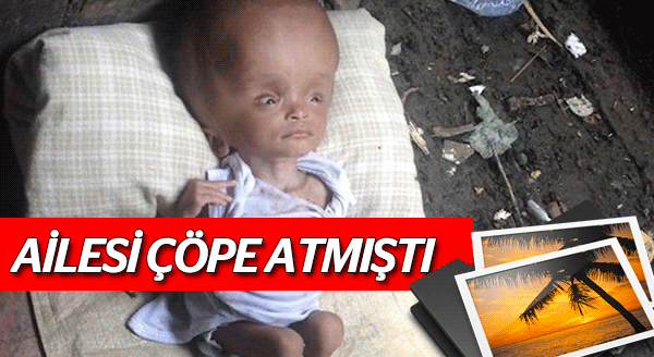 ONA BİR DE ŞİMDİ BAKIN