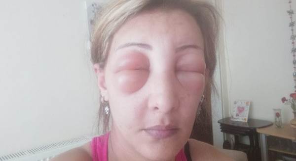 Saçlarını yaptırmak için kuaföre gitti, canından oluyordu