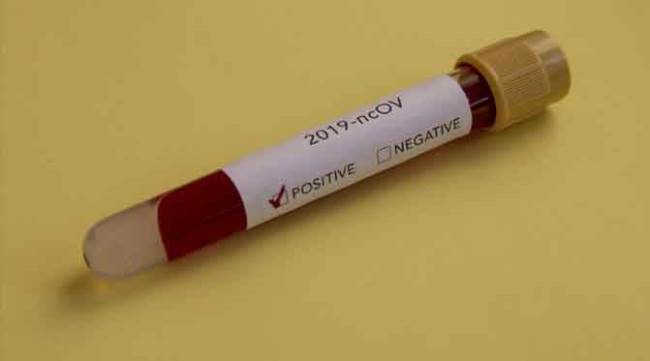 Eskişehir'de bir bürokrat daha koronavirüse yakalandı!