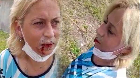 Eskişehir'de hayvansever kadın darp edildi