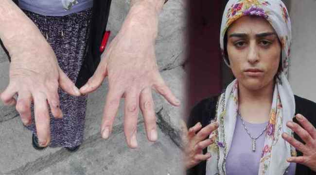 Genç kızın tek isteği tedavi olabilmek