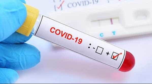 Koronavirüs testi pozitif çıktı