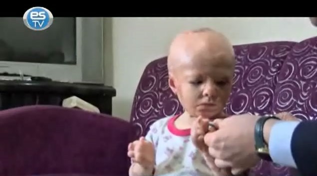 Minik yüreğin dramı