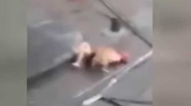 Pitbull sokak ortasında adamı parçaladı