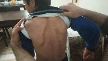 10 Yaşındaki Çocuğu Tırmıkla Yaraladı
