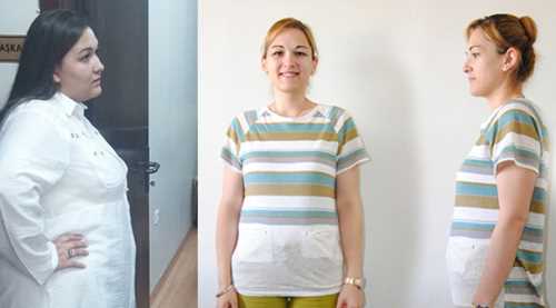 115 KİLODAN 60 KİLOYA DÜŞTÜ