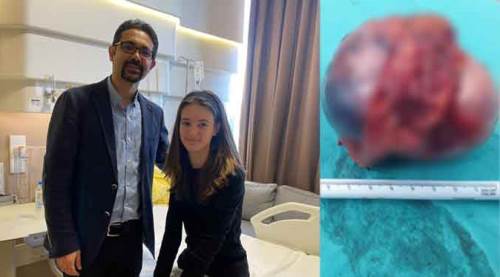 14 yaşındaki çocuğun böbreğinden bu çıktı!