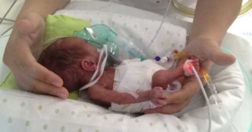 3 BUÇUK AY SONRA HAYATA TUTUNDU