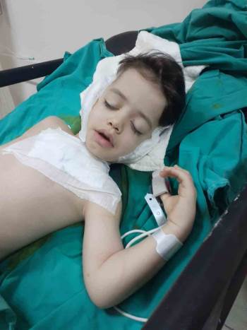 4 Yaşındaki Çocuğun 7 Ameliyat Sonrası Kulağının Çürüdüğü İddiasıyla İlgili Açıklama:
