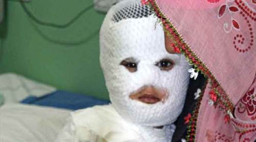 400 kişi tandır ve süt kazanında yandı