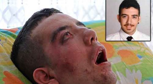 5 yıldır gözlerini bile kırpamıyor!