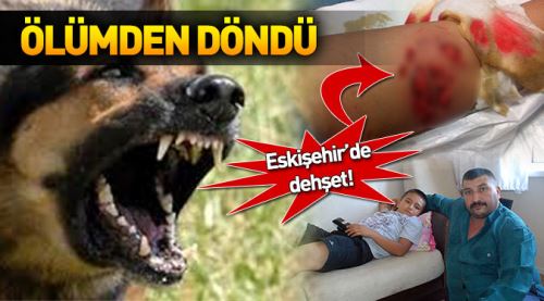 72 dikiş atıldı ağızlarından zor aldım!
