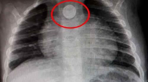 9 aylık bebek ölümden döndü!