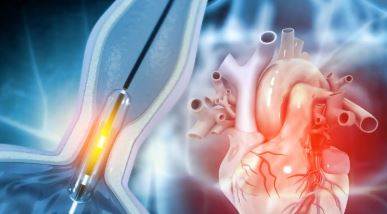 Ablasyon Ameliyatı Nedir? Kimlere Yapılır, Riskleri Var mı? Yapılmazsa Ne Olur? Kalp Ritmini Düzenleyen Hayati Müdahale
