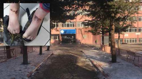 Afyon'da çözülemeyen gizem! Bu çocuklar neden yandı?
