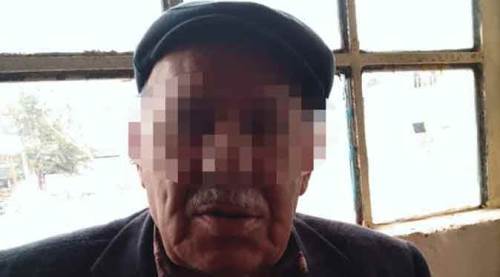 Afyon'da iğrenç olay: Küçük kızın vücudundaki morluklar...