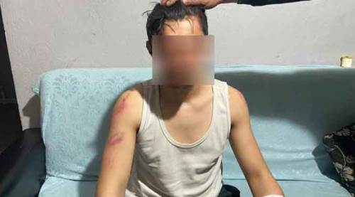 Afyonkarahisar'da 200 lira için akıl almaz vahşet!