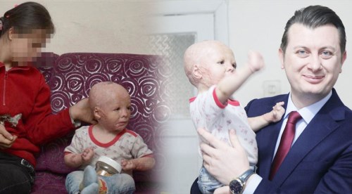 Ahmet bebekten sevindirici haber