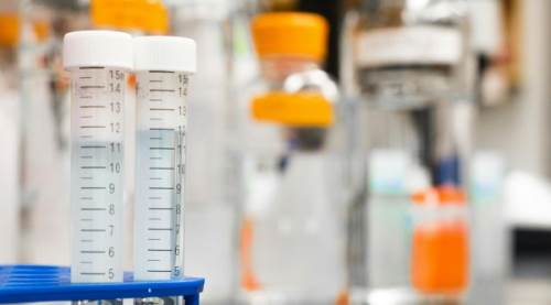 Anti CMV IgG Pozitif Ne Demek?