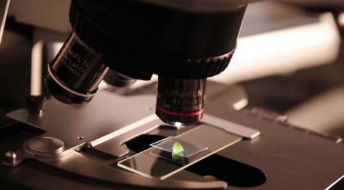  Anti-HAV IgG Pozitif Ne Demek? Belirtileri, Nedenleri ve Anlamı