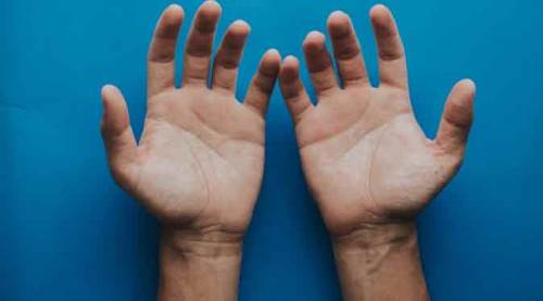 Aşırı terlemeniz varsa dikkat!