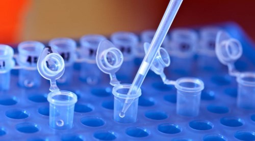 Babalık testi yaptıranların sayısında büyük artış!