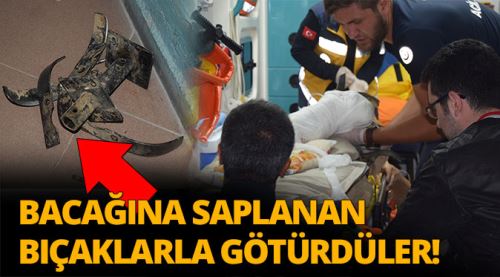 Bacağına saplanan bıçaklarla götürüldü!