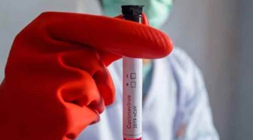 Bakan Koca'dan açıklama: Artan test sayısına rağmen...