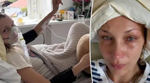 Bella Hadid'in Hastalığı Lyme Belirtileri, Nedenleri ve Tedavi Yöntemleri Hakkında Bilgiler