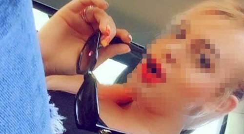 Bıçaklanırken "Öldür beni" diye yalvarmış