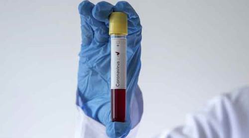 Bilecik'te o ilçede günlük vaka sayısı sıfırlandı!