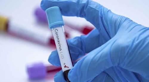 Bilecik'te sevindiren haber! Koronavirüs vakaları....