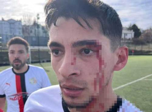 Bilecik’teki maçta korkutan kavga: 3 futbolcu hastanelik oldu