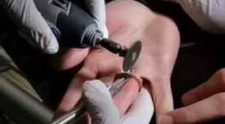 Böylesi görülmedi: Parmağını paraya sıkıştırdı!