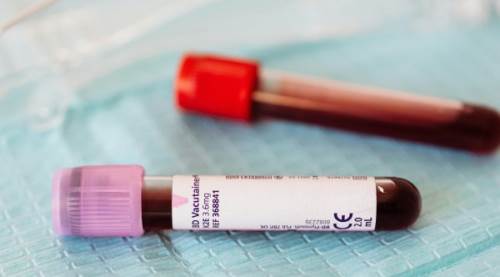 Bugün 8 Mayıs Dünya Talasemi Günü: Talasemi Nedir, Belirtileri Neler?