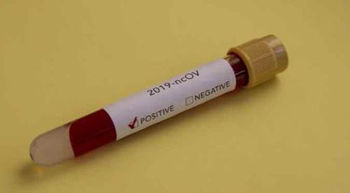 Bugün tespit edilen vaka sayısı bin 154!